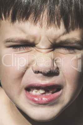 Child shows missing teeth