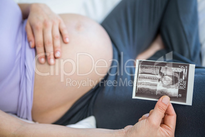 Pregnant woman showing ultrasound scan