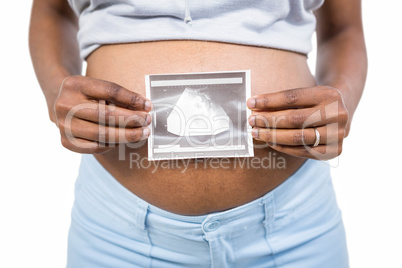 Pregnant woman holding ultrasound scan