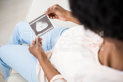 Pregnant woman holding ultrasound scan