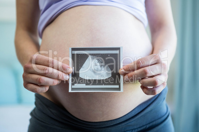 Pregnant woman holding an ultrasound