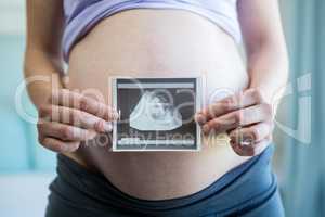 Pregnant woman holding an ultrasound