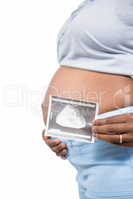 Pregnant woman holding ultrasound scan