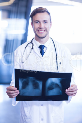 Doctor holding an x-ray in hospital