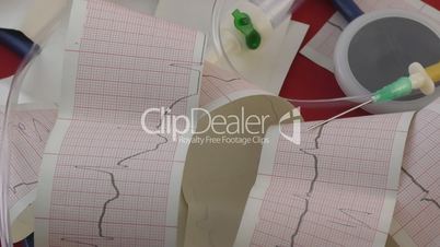 Electrocardiogram of the heart