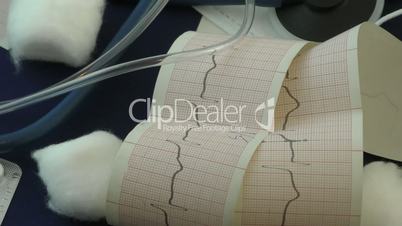 Electrocardiogram of the heart