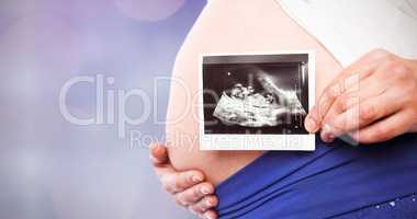 Composite image of pregnant woman showing ultrasound scans