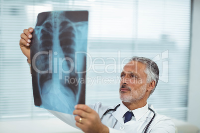 Doctor checking a x-ray report