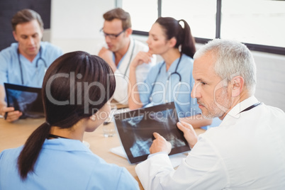 Doctors examining an x-ray report