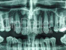 Human teeth xray