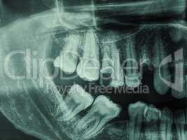 Human teeth xray