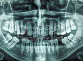 Human teeth xray