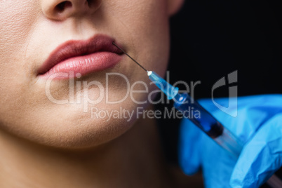 Woman receiving botox injection on her lips