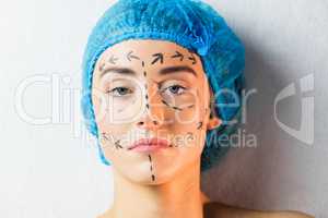 Peaceful young patient with dotted lines on the face