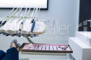 Dental tools and equipment