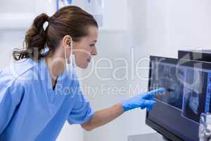 Dental assistant examining an x-ray on the monitor