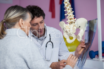 Physiotherapist explaining x-ray to patient