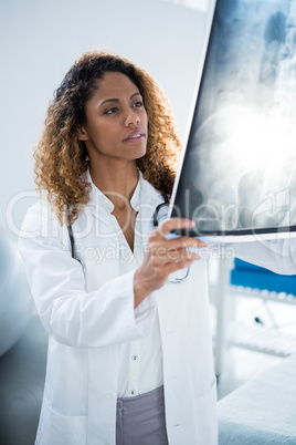 Physiotherapist holding spine x-ray of patient