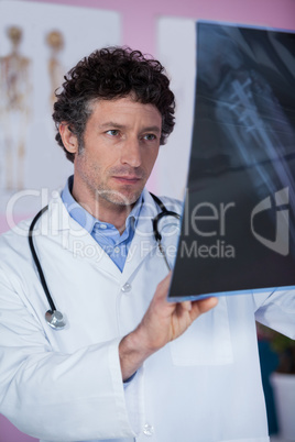 Physiotherapist examining x-ray of patient