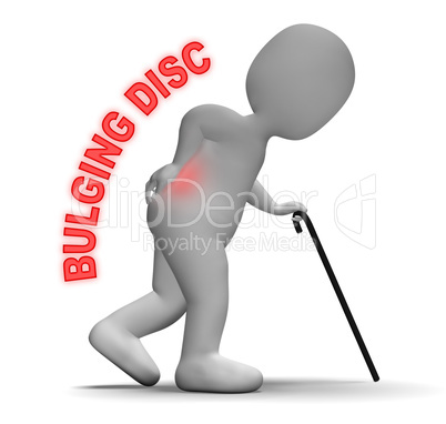Bulging Disc Shows Back Chiropractor 3d Rendering