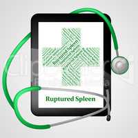 Ruptured Spleen Shows Splenic Injury And Affliction