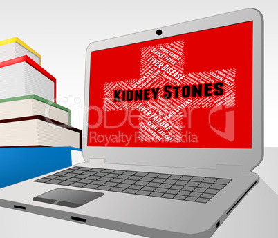 Kidney Stones Represents Ill Health And Advertisement