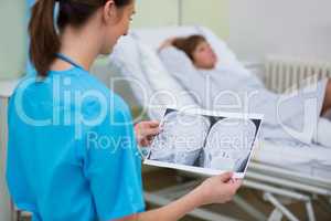 Nurse checking a x-ray in hospital ward