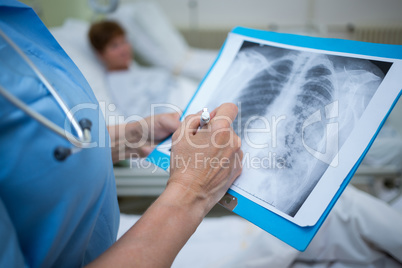 Doctor examining x-ray of patient