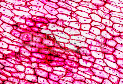 Onion epidermus micrograph