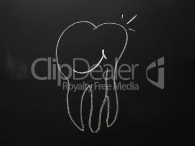 Hand drawn tooth on a chalkboard