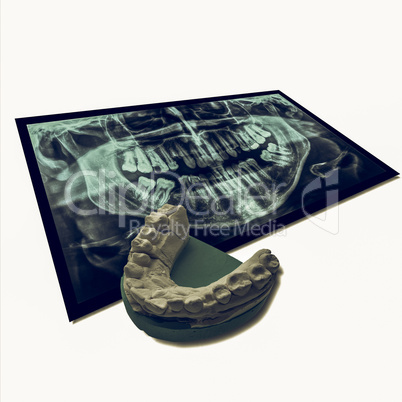 Vintage looking Xray of teeth with positive teeth cast