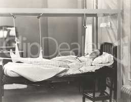 Man with fractured leg sleeping on hospital bed