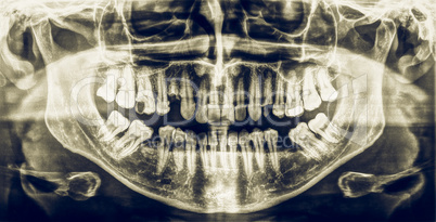 Vintage looking Medical Xray