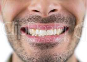 Man showing his teeth
