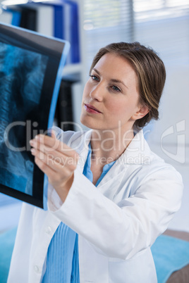 Female doctor examining x-ray report