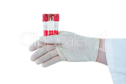 Doctor hand wearing medical gloves holding test tubes