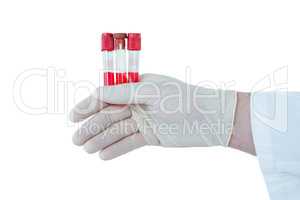 Doctor hand wearing medical gloves holding test tubes