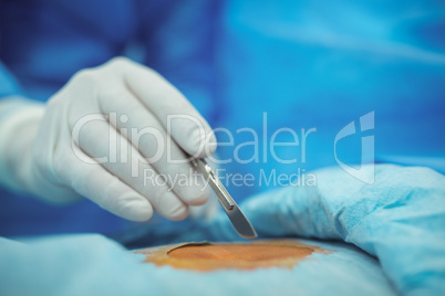 Surgeon with scalpel performing operation in operation theater