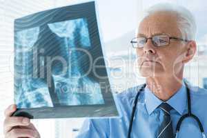 Doctor analyzing x-ray report
