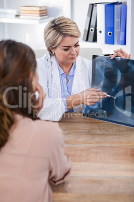 Female doctor explaining x-ray report to patient