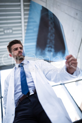 Doctor examining X-ray report