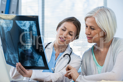 Female doctor explaining x-ray report to patient