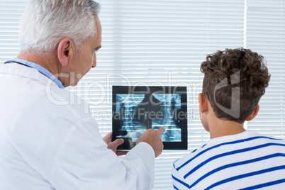 Doctor discussing x-ray report with patient