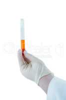 Doctor hand wearing medical gloves holding a test tube