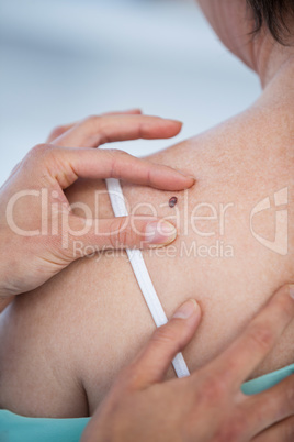 Dermatologist examines a mole of female patient
