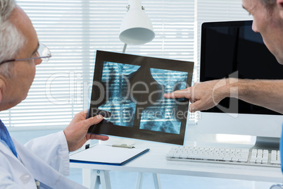 Surgeon and doctor discussing x-ray report