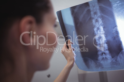 Female nurse examining x-ray report