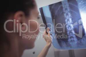 Female nurse examining x-ray report
