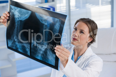 Female doctor examining x-ray report