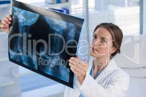Female doctor examining x-ray report